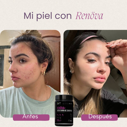 COLÁGENO RENOVA PLUS - Dosis diaria de juventud